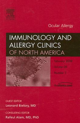 Eye Allergy Overview