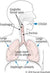 Cough: COVID 19 versus allergic-cough, asthma-cough, chronic cough